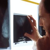 2021.11.30(火)日経実力病院調査「乳がん」について～／都道府県別 乳がん死亡数（75歳未満）と男性の乳がんのはなし
